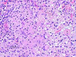 Mycobacterium marinum